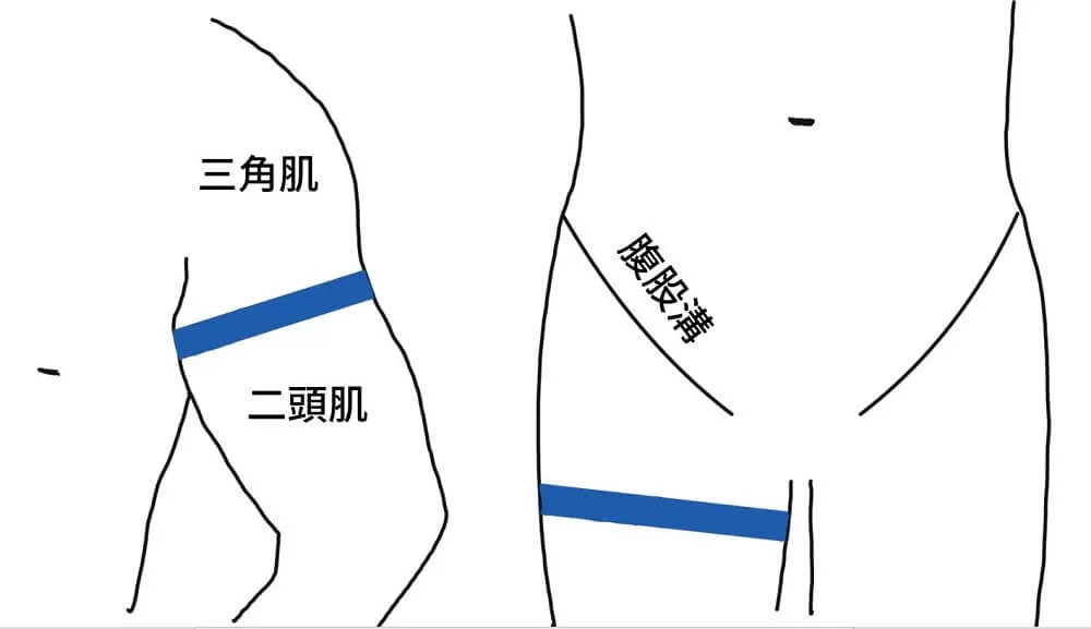 綁帶綑綁位置