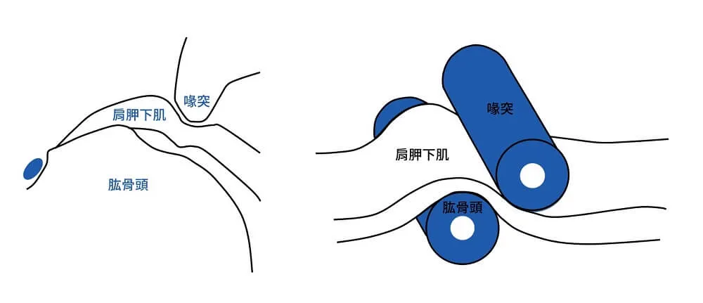 Roller-wringer effect 示意圖